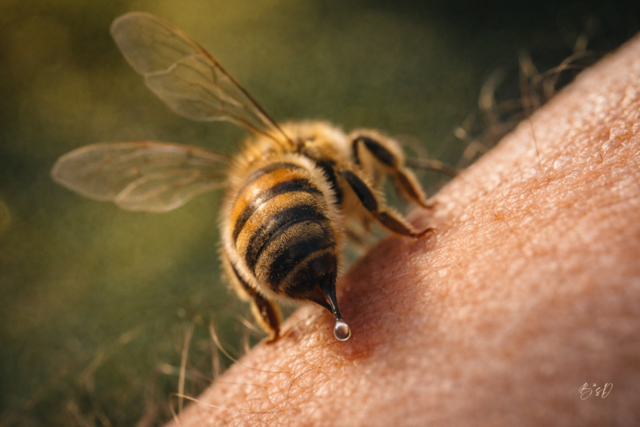 Macro close-up of a honeybee stinging human skin with a visible droplet of venom, highlighting bee venom therapy, apitherapy research, and the medicinal properties of bee venom.